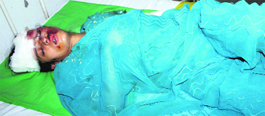 An injured woman undergoes treatment at the Sector 6 General Hospital in Panchkula on Sunday.