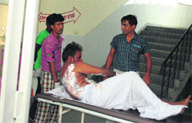 The man who set himself afire under treatment at Civil Hospital, Ludhiana, on Sunday.
