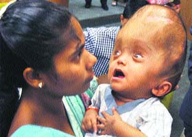 Baby Roona along with her mother at the Fortis Memorial Research Institute in Gurgaon