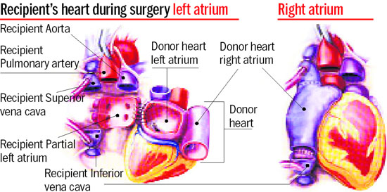 Punjab Human Organ Transplantation Authority on X: According to Islamic  teachings, organ donation is a very good deed and can be done even after  the donatee has passed away after proper undertaking