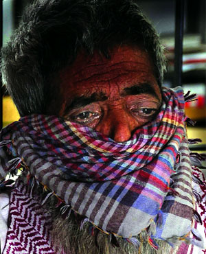 With over 2 million TB cases reported per year, the disease continues to be one of the leading cause of death in India. 