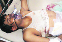The persons who were injured in firing by robbers in Amritsar on Wednesday.