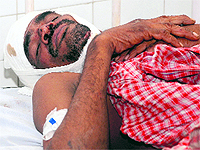 The suspected member of the Kala Kachha gang undergoes treatment at Civil Hospital in Kharar on Sunday
