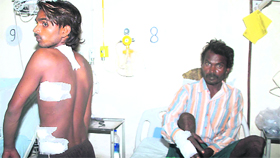 Tinku (left) and his father, who were attacked by robbers, at a hospital in Mohali on Thursday.