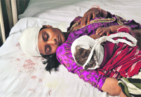 A woman and her child, who were injured in the communal clashes. 