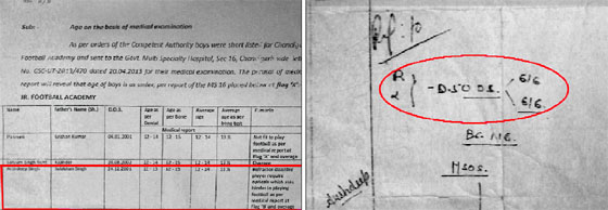 While the report of the GMSH-16 says Arshdeep has refractive disorder, the PGI report (right) says he has a perfect eyesight.