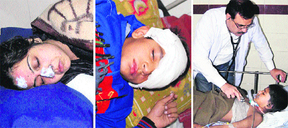 Victims of burn injuries being treated at various hospitals in Jalandhar on Monday.