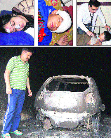 (Top) Some victims of burn injuries being treated at various hospitals in Jalandhar on Monday; and (below) an Alto car which caught fire as firecrackers reportedly fell on the vehicle on Diwali night in Jalandhar. 