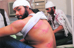 The injured students at a hospital in Mohali on Thursday. Tribune Photo: Vicky Gharu