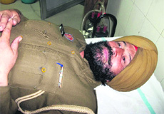 Head constable Baljit Singh, posted with Chheharta police, Amritsar, who was allegedly kidnapped and beaten up by several youths. 