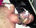 Komalpreet Singh and his mother Paramjit Kaur (right) at the Guru Nanak Dev Hospital in Amritsar on Sunday