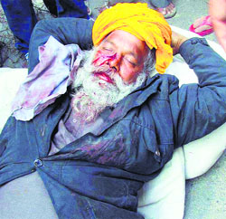 Injured Harpal Singh