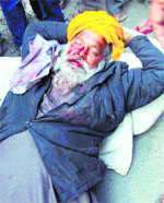 Harpal Singh was attacked by former Jathedar Giani Puran Singh, his son Ajai Singh, nephew Ajmer Singh and five others on Monday