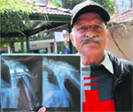Col ( retd) RS Sanyal shows an X-ray of his wife in Mohali on Monday. tribune photo: vicky gharu