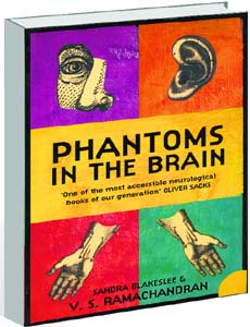 Phantoms in the Brain