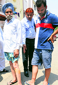 Mohinder Singh and Vivek, and (below) nine-year-old Nishtha, who were injured after being attacked by dogs in Sector 20-A, Chandigarh, on Wednesday