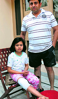 Mohinder Singh and Vivek, and (below) nine-year-old Nishtha, who were injured after being attacked by dogs in Sector 20-A, Chandigarh, on Wednesday