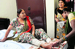 Sangeeta, who was injured after being attacked by dogs in Sector 20-A, Chandigarh, on Wednesday