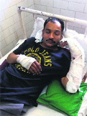 A badly injured Baljinder Sharma in Kapurthala. 