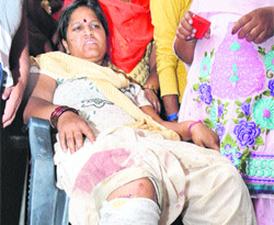 The injured residents of Ajit Nagar show their injury marks outside the Police Commissioners office.