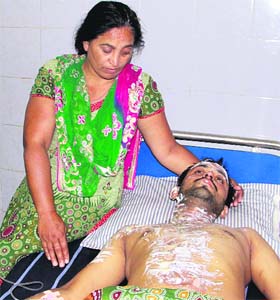 The 21-year-old victim of acid attack at a hospital in Jalandhar on Wednesday