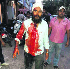 Darshan Singh, who was injured after the compressor of an AC exploded at a shop in Zirakpur on Thursday evening.