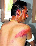 Ram Pal shows his injuries