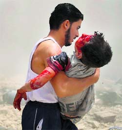 A man carries an injured child after a car blast in a market in central Douma, near Damascus, on Saturday.