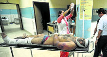 Gangwar victim, who sustained serious injuries, at the Civil Hospital in Jalandhar