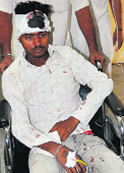 The victim, Amar, at the Civil Hospital in Phase VI, Mohali,  on Saturday. 
