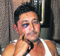 Injured BJP worker Harbhajan Singh
