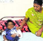 The victim, Kusma Devi, at the GMSH-16 in Chandigarh on Wednesday. Tribune Photo: Manoj Mahajan