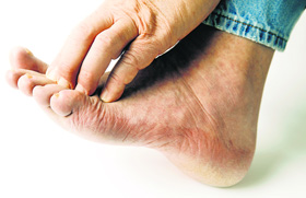 If a foot sore hasnt healed within a normal duration, immediately contact your doctor