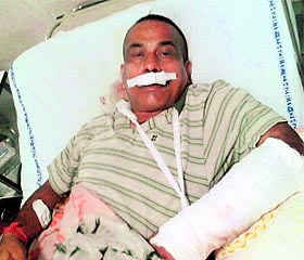 Whistleblower Dinesh Kumar admitted to the GMSH, Sector 16, Chandigarh, on Sunday. A Tribune photograph