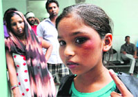 Shakina shows the injury mark on her face at the Civil Hospital in Bathinda on Saturday. Tribune photo: Pawan sharma