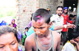 An injured youth shows his bruises in Bathinda on Tuesday