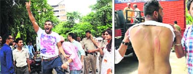 A PUSU supporter, who was allegedly beaten up by NSUI workers, raises slogans on the PU campus on Thursday; and (right) injury marks on his back