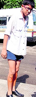 One of the injured boys
