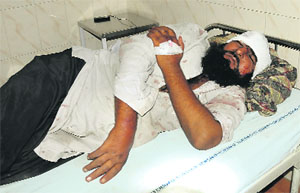 one of the injured, Rehman Ali, under treatment at the GMSH, Sector 16. 