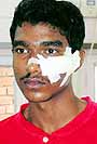 Pradeep from Tamil Nadu who was injured during a match in Chandigarh